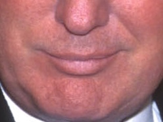 Illustration for article titled A Visual History of Donald Trump's Mouth